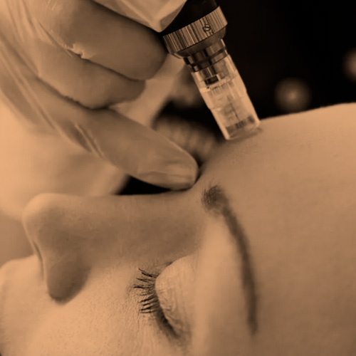 Dermapen Treatment - Doctor-led aesthetics and cosmetic treatment provider Lewes - Contact us today for more information.